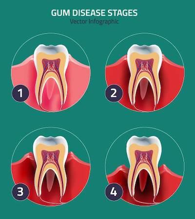 brisbane dentist