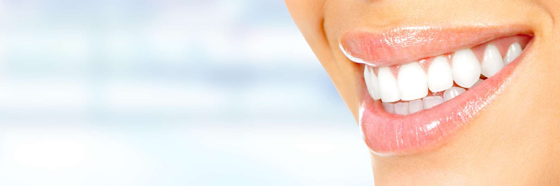 highgate hill teeth whitening