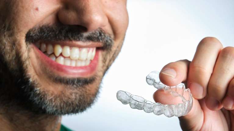 clear aligners in highgate hill qld